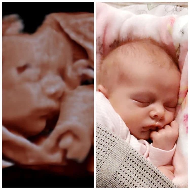 Before & After: 3D/4D Scan