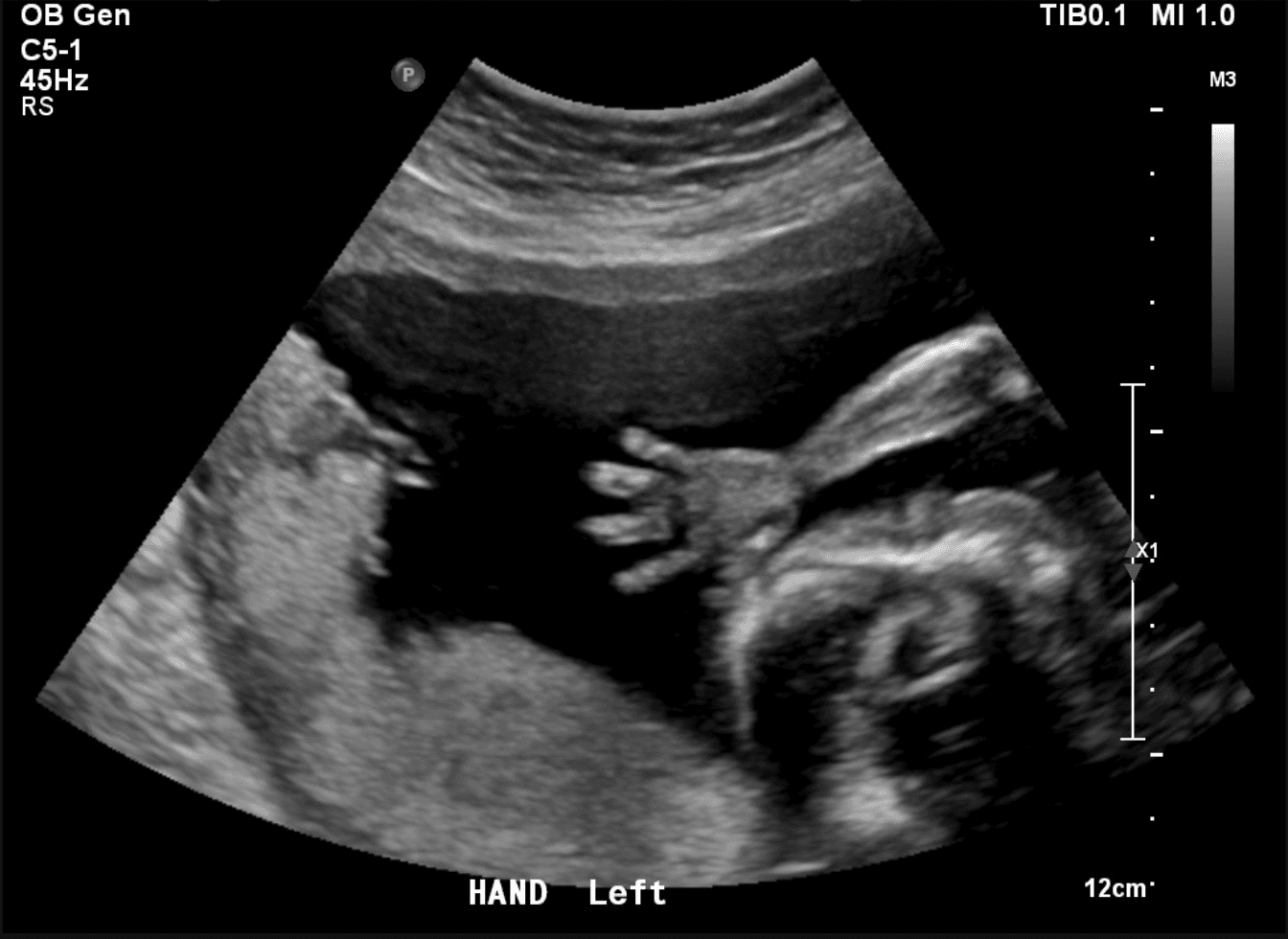 Scan of the Week: Waving Hand!