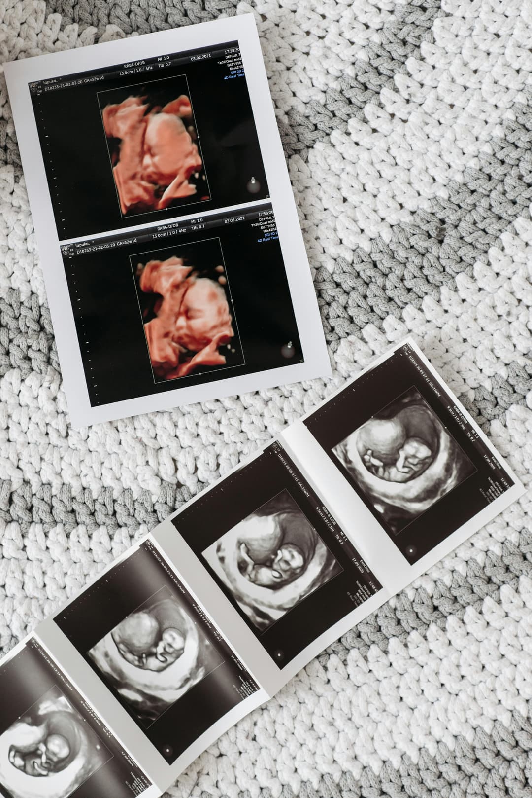 Sonographer performing 3D/4D baby scan