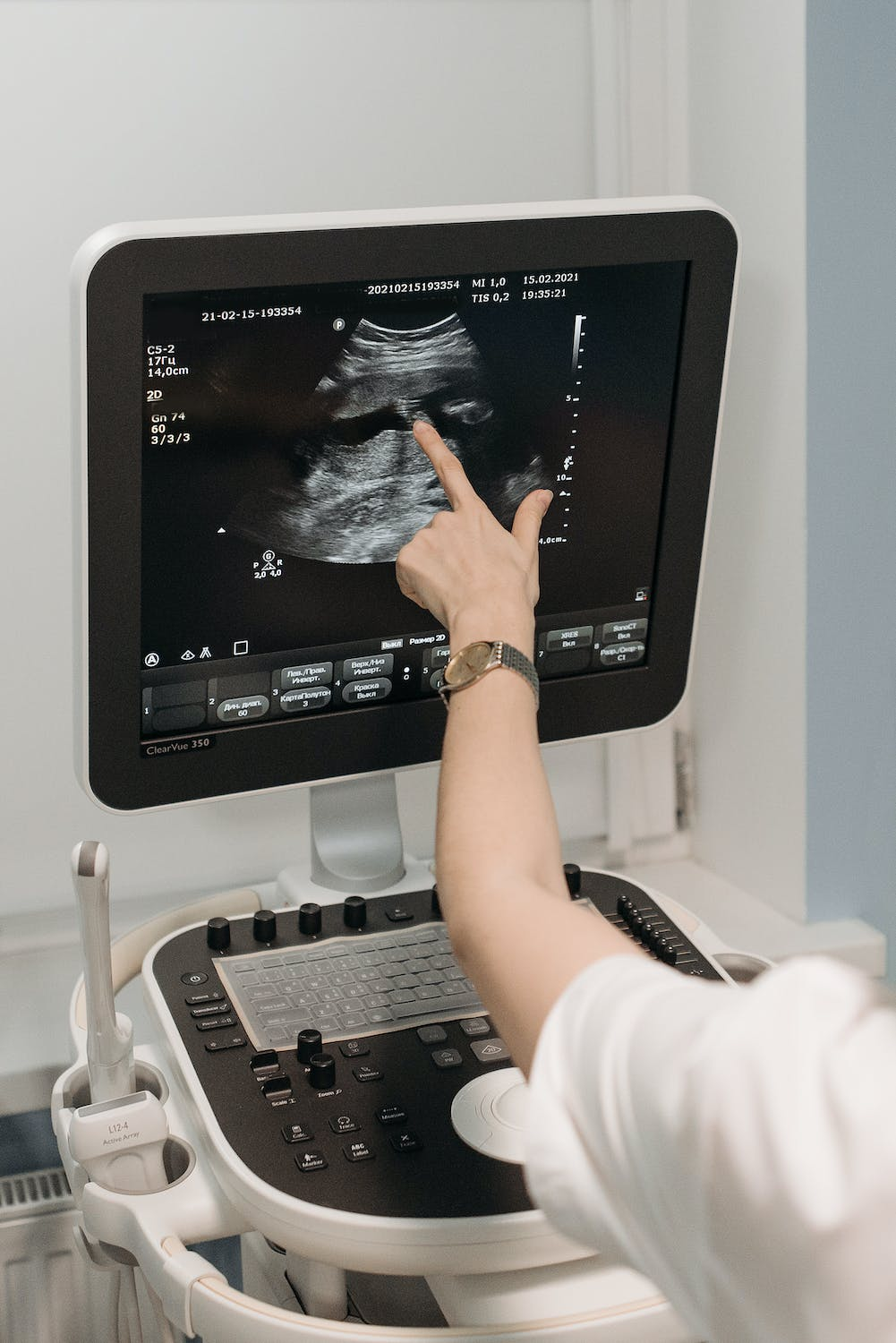 Medical ultrasound scan being performed