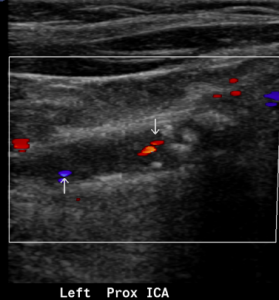 Neck Ultrasound